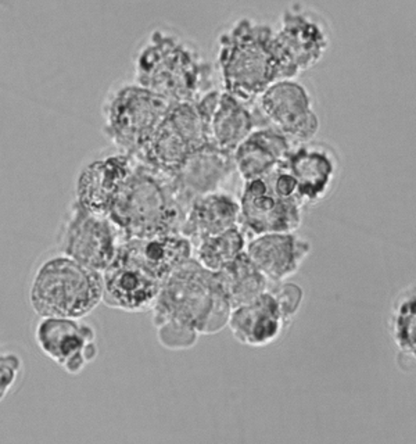Cells after background normalization